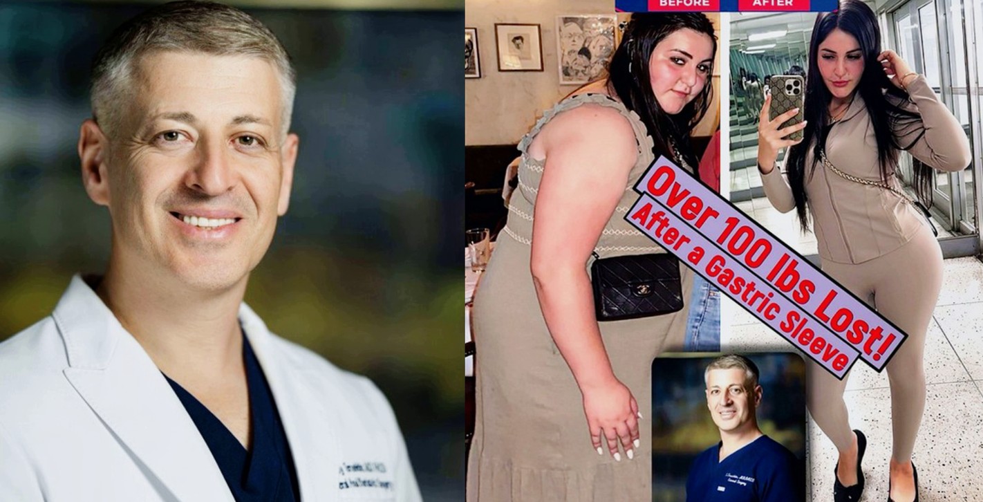 lost over 100 lbs gastric sleeve before and after Dr. Terushkin