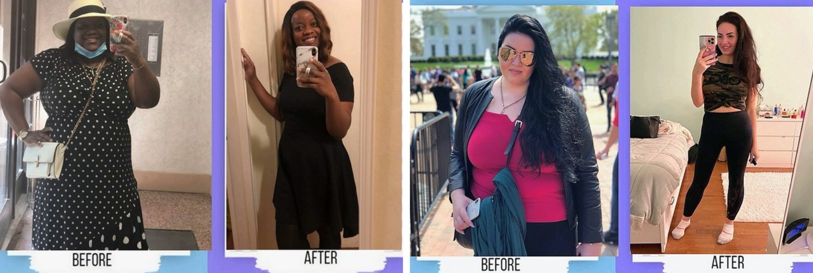 before and after weight loss Brooklyn, Goal BMI dr. Terushkin